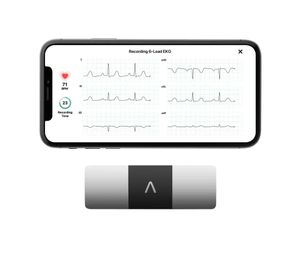 ALIVECOR Preview